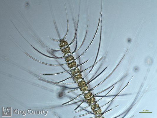 Photo of Chaetoceros eibenii